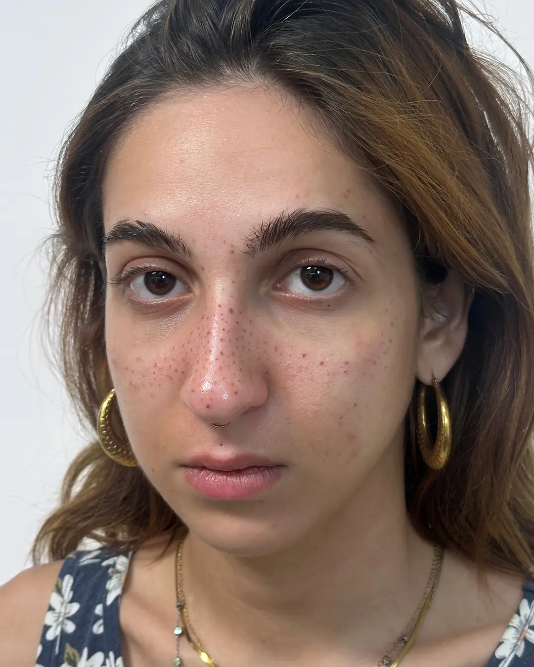 freckles tattoo